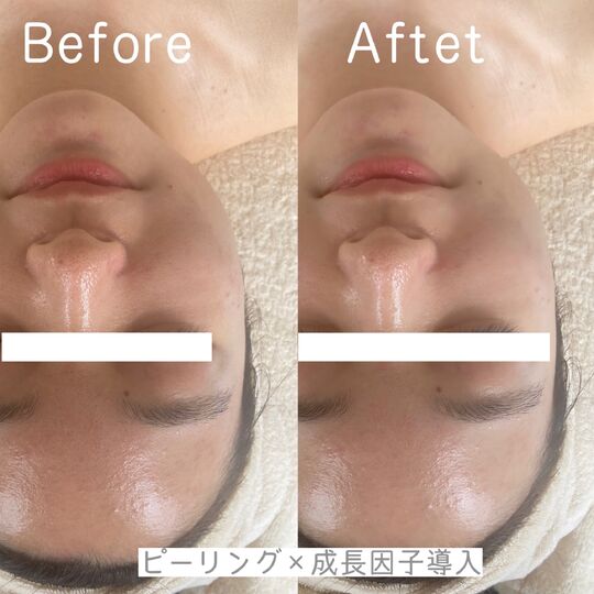 施術事例をギャラリーで多数掲載